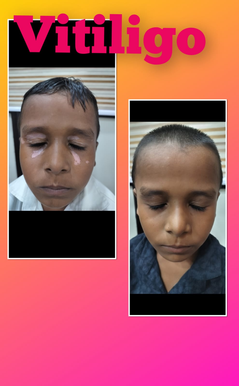 Treatments